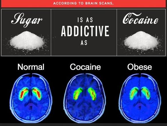 brain on sugar